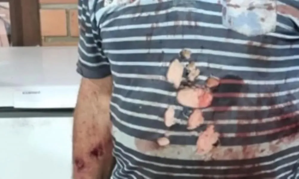 Agricultor sofreu ferimentos em várias partes do corpo e foi socorrido para o posto de saúde - Foto: Reprodução/Especial