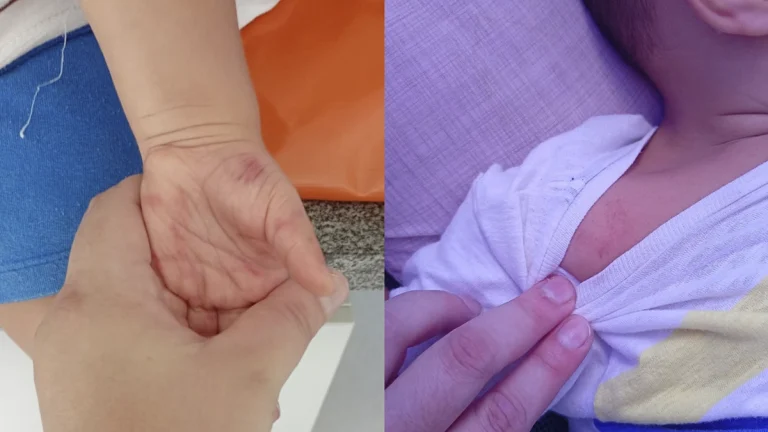 Ex-servidora de creche é presa por agredir bebê de 1 ano