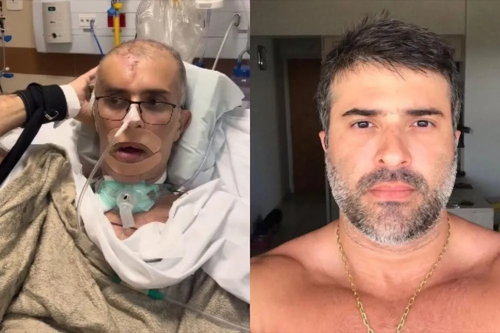 Felipe Marques resistiu cerca de 1 ano e dois meses após os graves ferimentos sofridos - Fotos: Reprodução