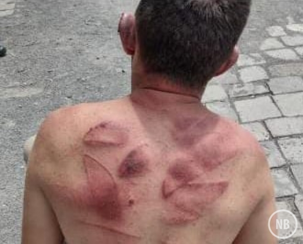 Morador de Bento é agredido por populares em Caxias do Sul acusado de pedofilia