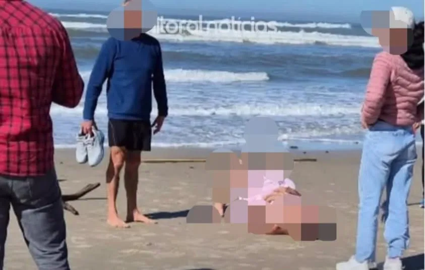 Ataque de Rottweiler deixa homem gravemente ferido em praia de Torres