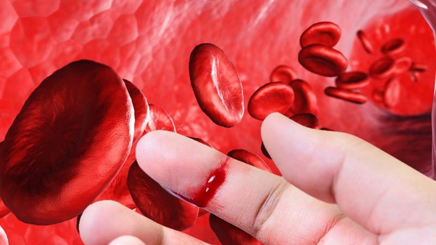 Já ouviu falar sobre hemofilia ?