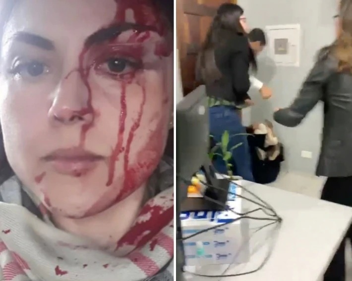 Procuradora Gabriela de Barros sofreu ferimentos na cabeça após ser agredida pelo colega - Foto: Reprodução
