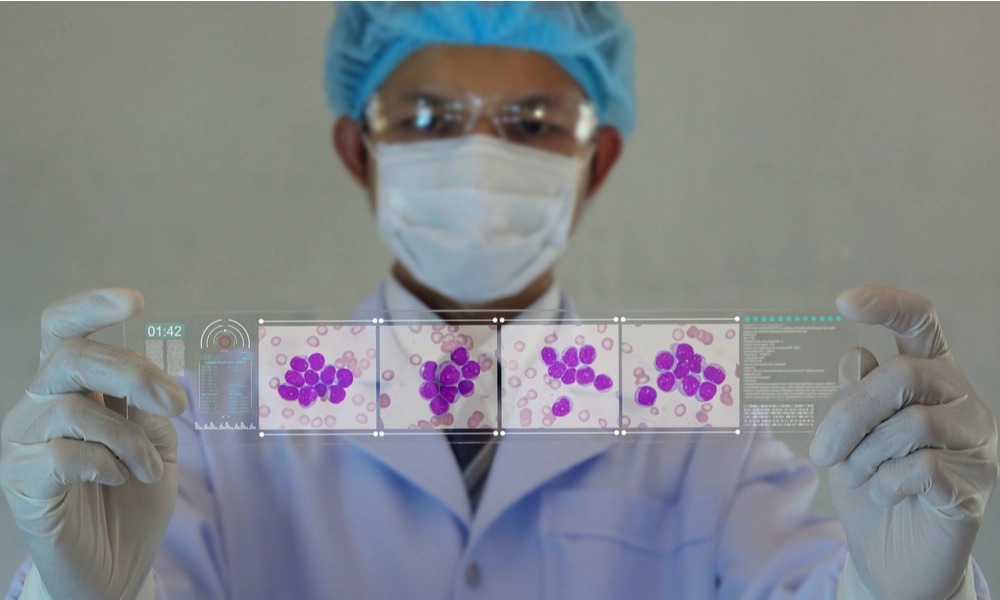 Centro de Coletas de Células-Tronco que passa a ser sediado na Universidade de Caxias do Sul será lançado na segunda-feira, 4 de julho