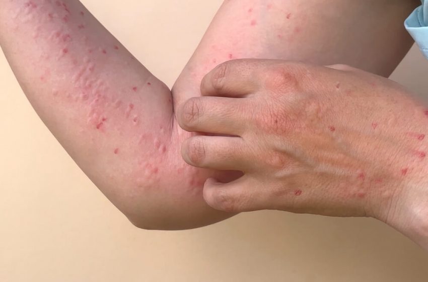 Crédito: Reprodução 