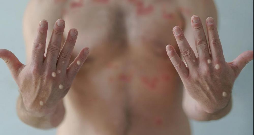 O imunizante deve chegar nas próximas semanas. Crédito: Reprodução