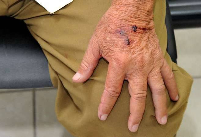 Idoso é agredido e vítima de estrangulamento pelo próprio filho