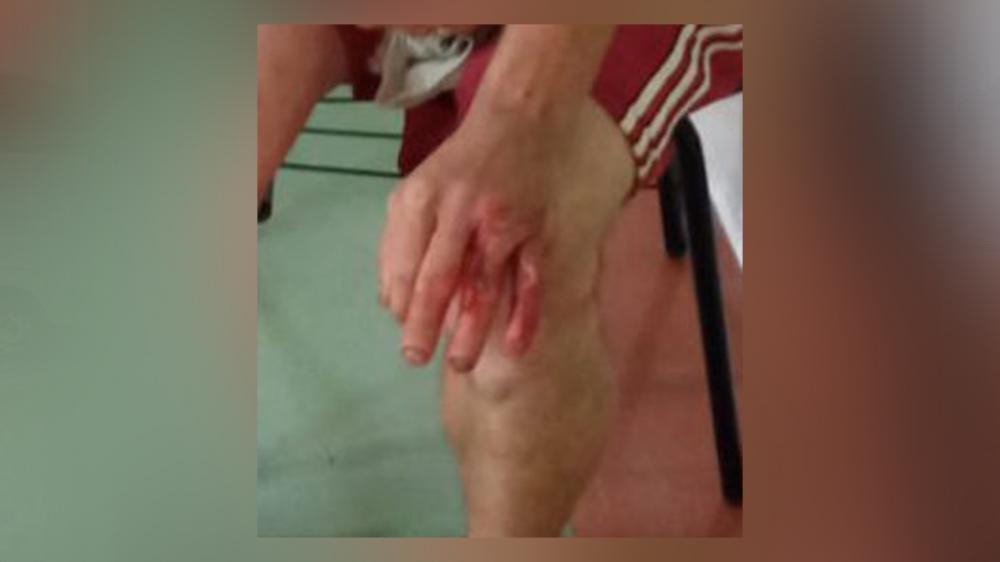 Homem tenta matar o próprio irmão em Farroupilha