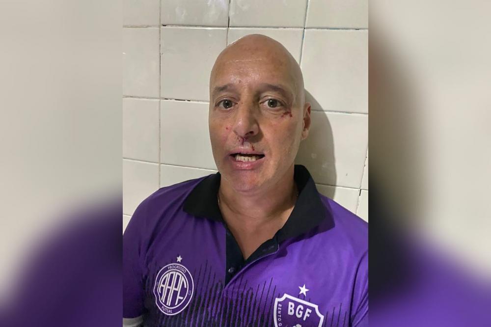 Técnico do BGF/AAPF é agredido e time sai de quadra na semifinal da Série Ouro