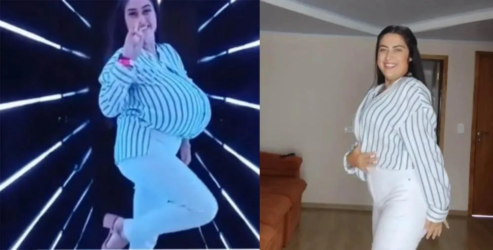 Jovem de 22 anos perde 10 quilos após realizar cirurgia de mamas