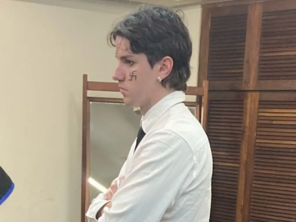 Estudante de 28 anos precisou apagar a