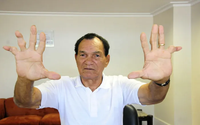 Goleiro mostrava sempre os dedos tortos, devido ao fato de jogar sem luvas - Fotos: Reprodução/Especial